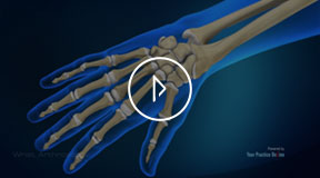 AC Joint Arthritis Surgery - From Consultation to Treatment - Dr. Van Thiel